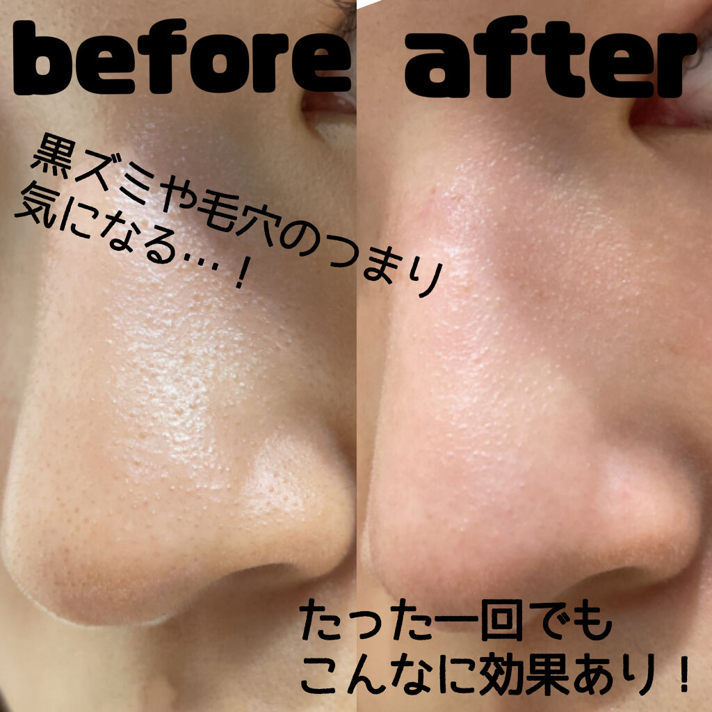 クレンジングバーム モイスト/CLAYGE/クレンジングバームを使ったクチコミ（3枚目）