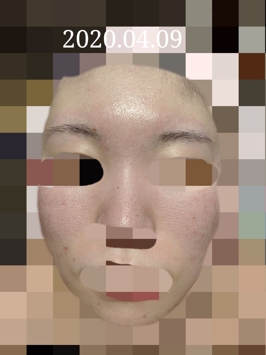 薬用 クリアローション M(しっとりタイプ)/オルビス/化粧水を使ったクチコミ（1枚目）