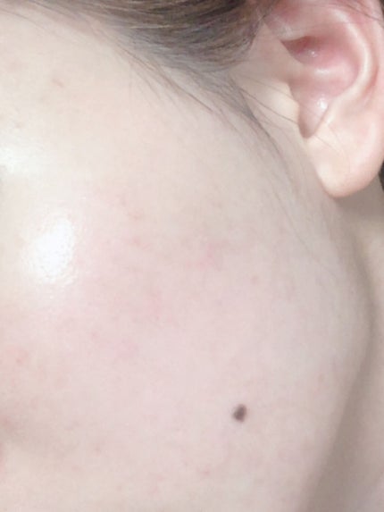 皮脂トラブルケア ミニセット/キュレル/スキンケアキットを使ったクチコミ(2枚目)