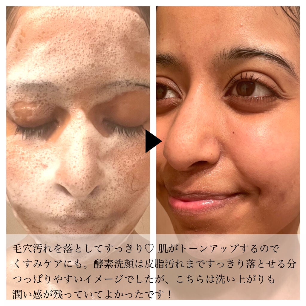 フルモア ピールナイトジェル/FRU MOR/フェイスクリームを使ったクチコミ(4枚目)