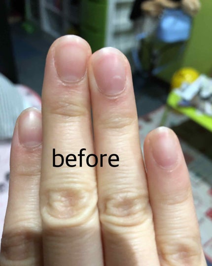 エテュセ クイックケアコート/ettusais/ネイルオイル・トリートメントを使ったクチコミ(2枚目)