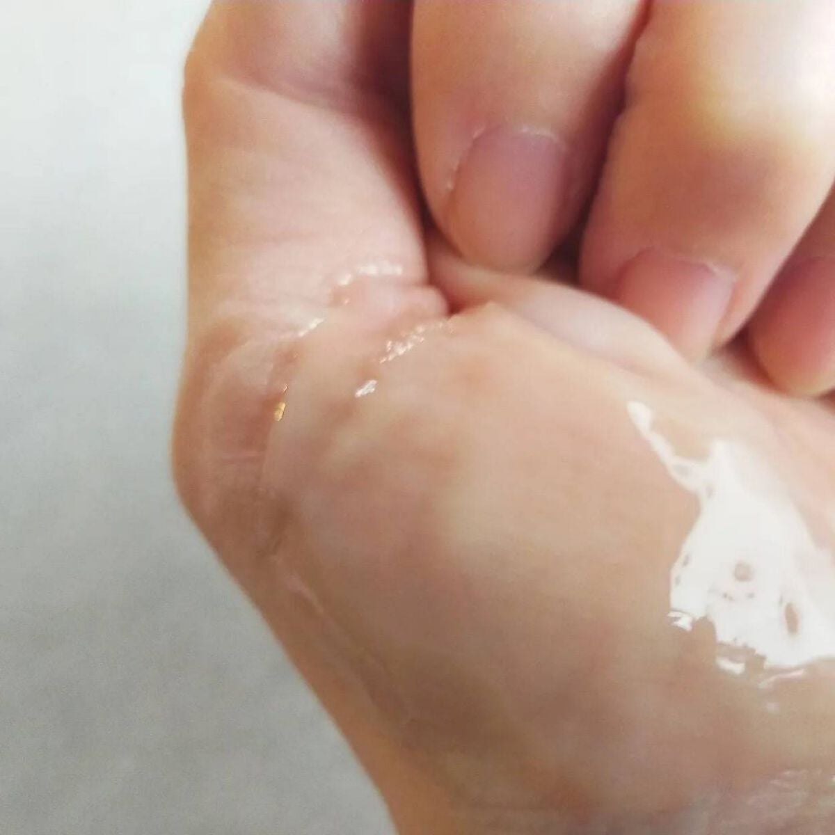 夢みるバーム アクネクリアモイスチャー/ロゼット/クレンジングバームを使ったクチコミ(5枚目)