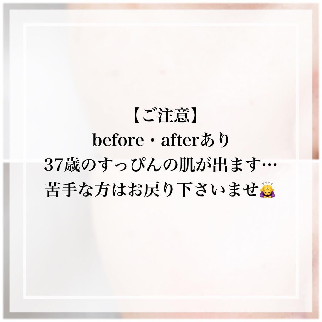 ピンクティーツリーカバークッション/APLIN/クッションファンデーションを使ったクチコミ(7枚目)