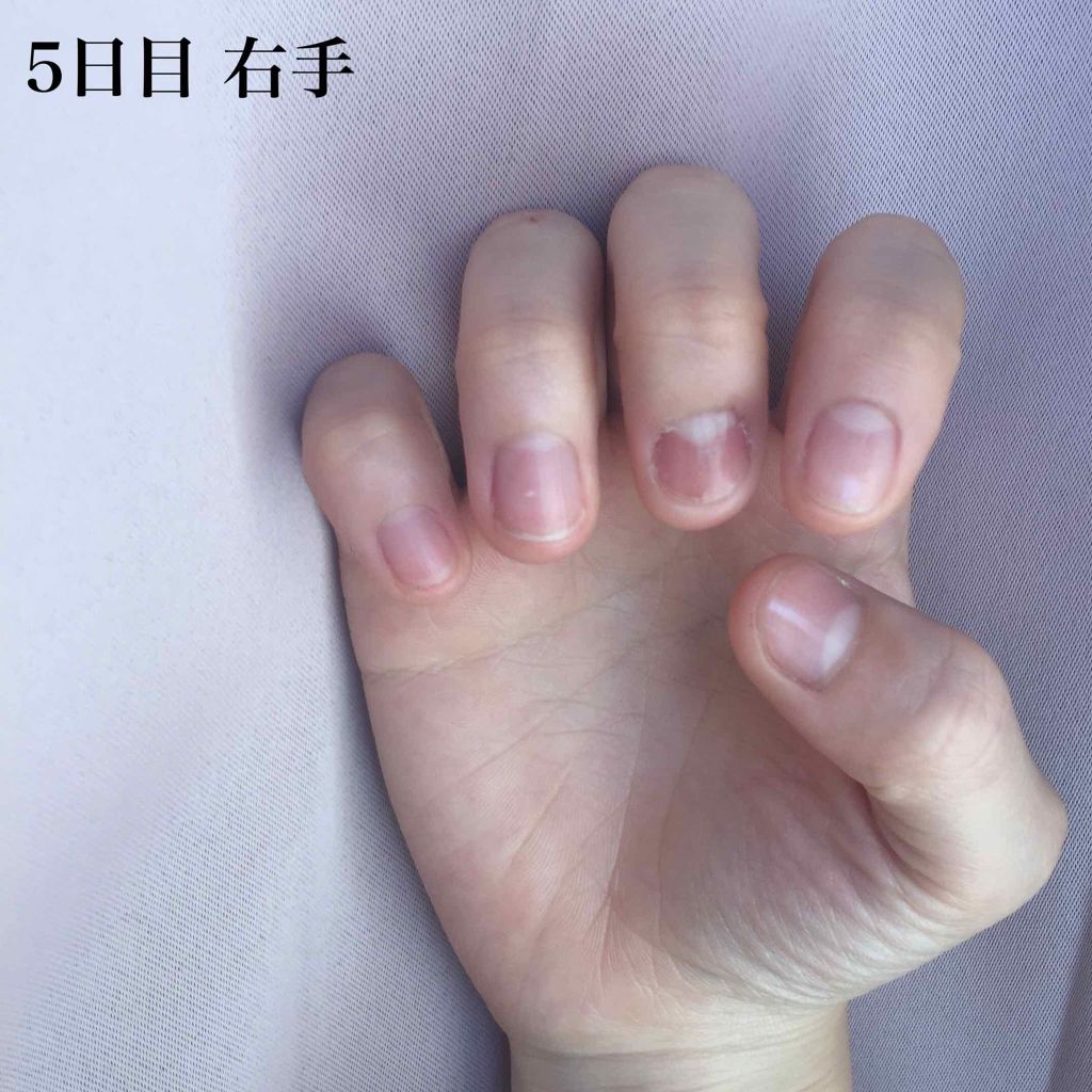 ピンクピンク on LIPS 「みなさんこんにちはこんばんは«爪を噛んでしまう癖をなくそう企画..」(2枚目)