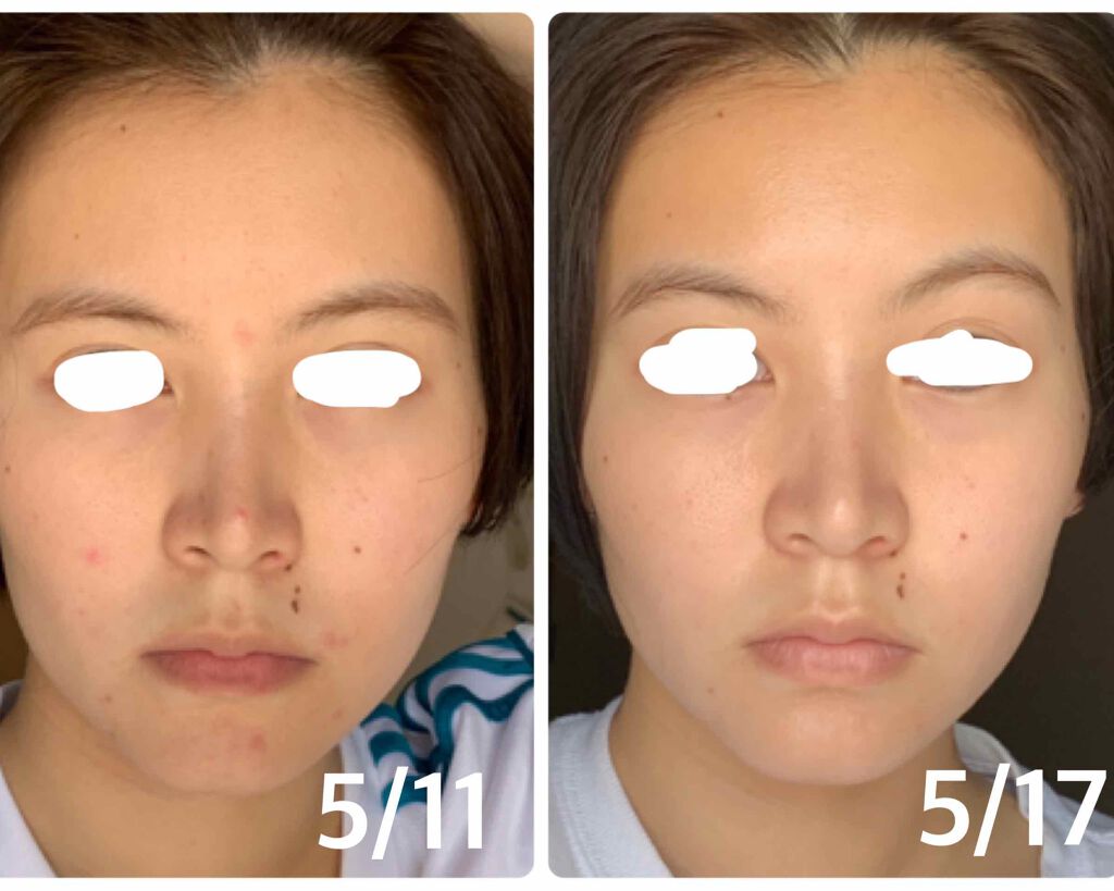 スキンケアセット(とてもしっとり)/IHADA/トライアルキットを使ったクチコミ(1枚目)