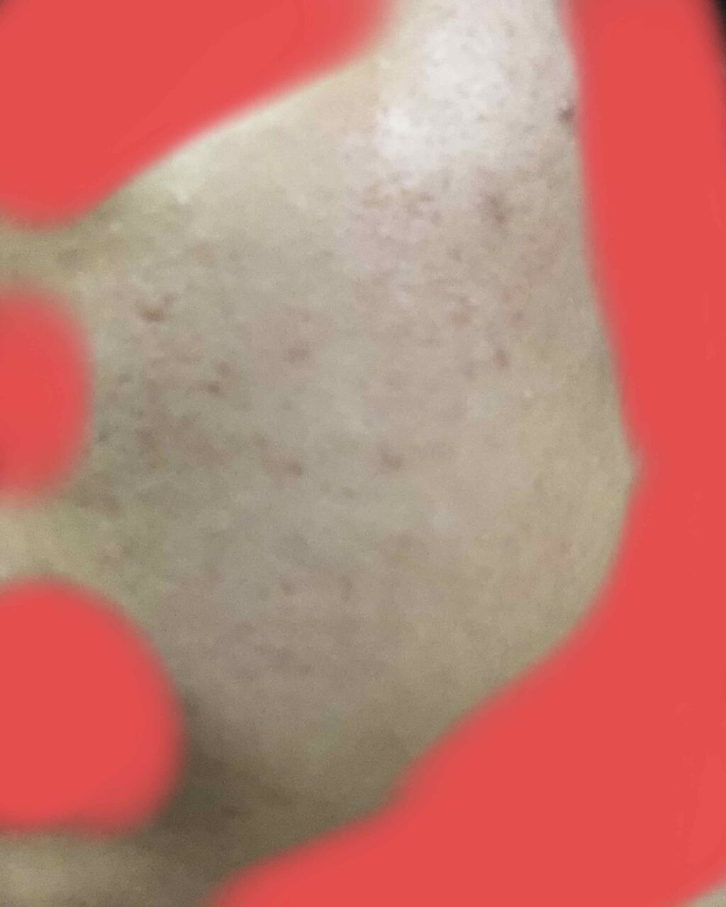 ノブ Ａ アクネソープ/NOV/洗顔石鹸を使ったクチコミ（2枚目）