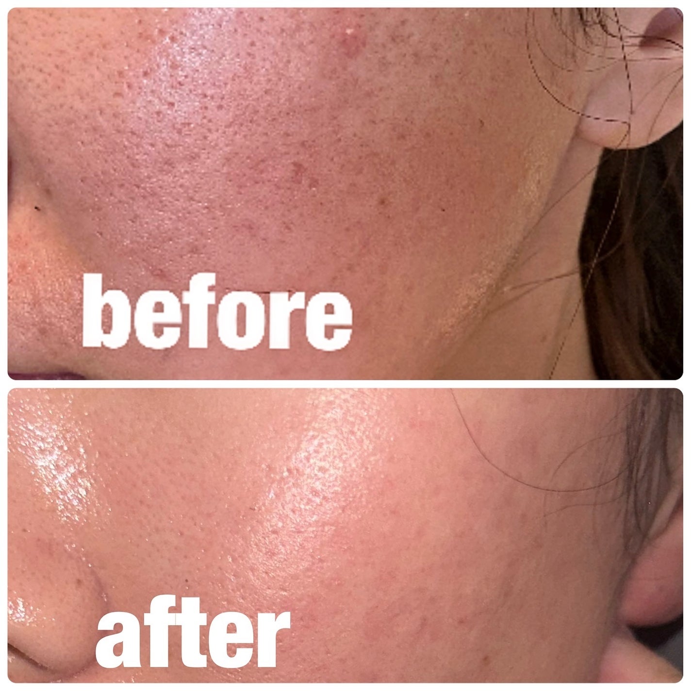 ゼロ毛穴1DAYセラム/MEDICUBE/美容液を使ったクチコミ(3枚目)