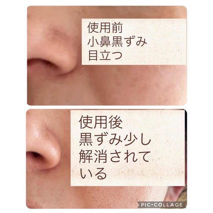 ゼロ毛穴パッド 2.0/MEDICUBE/トナーパッドを使ったクチコミ(5枚目)