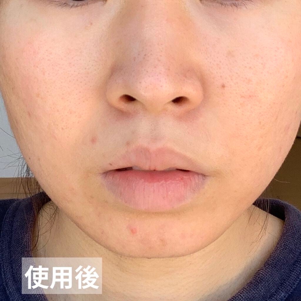 ハトムギ化粧水(ナチュリエ スキンコンディショナー R )/ナチュリエ/化粧水を使ったクチコミ(6枚目)