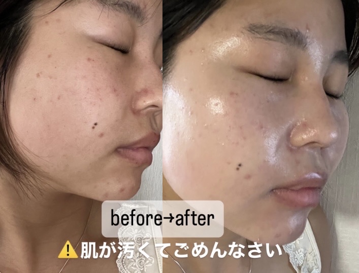 UVクリーム/Waphyto/日焼け止めクリームを使ったクチコミ（2枚目）