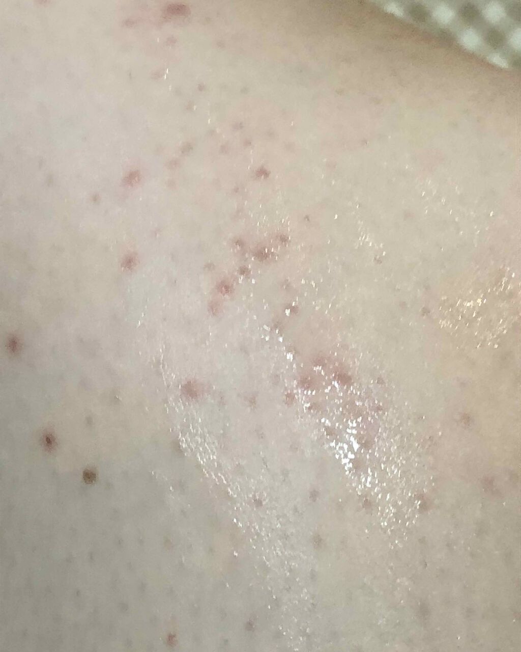 イントゥイション 敏感肌用 ホルダー （刃付き）＋替刃１コ/イントゥイション/シェーバーを使ったクチコミ（2枚目）