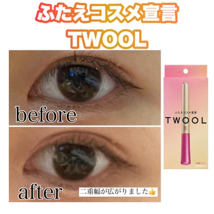 TWOOL ダブルアイリッドグルー/SHOBIDO/二重まぶた用アイテムを使ったクチコミ(1枚目)