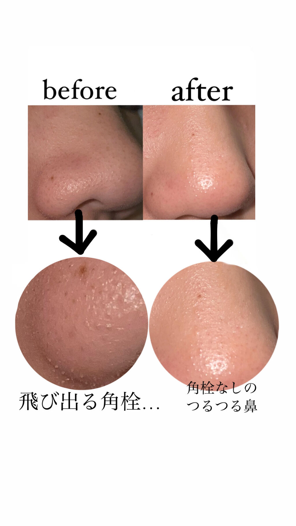 ピッグクリアブラックヘッド3ステップキット(鼻パック)/HOLIKA HOLIKA/シートマスク・パックを使ったクチコミ（2枚目）