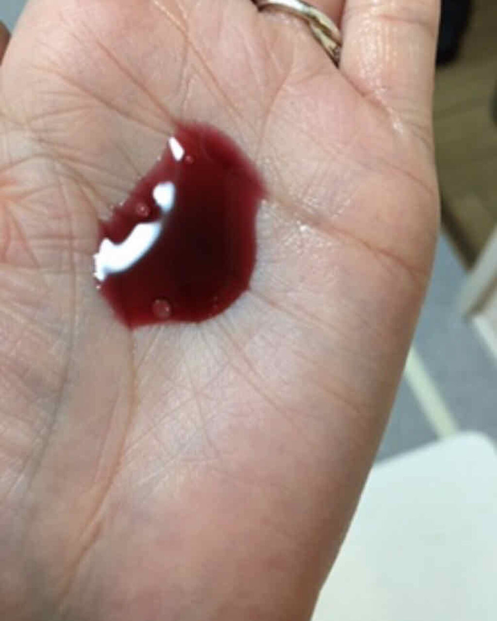 AHA 30% + BHA 2% Peeling Solution/The Ordinary/ピーリングを使ったクチコミ（2枚目）