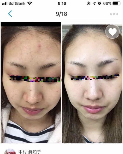 を使ったクチコミ(1枚目)