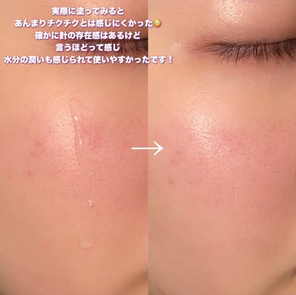 パンテショット675/COSNORI/美容液を使ったクチコミ(6枚目)