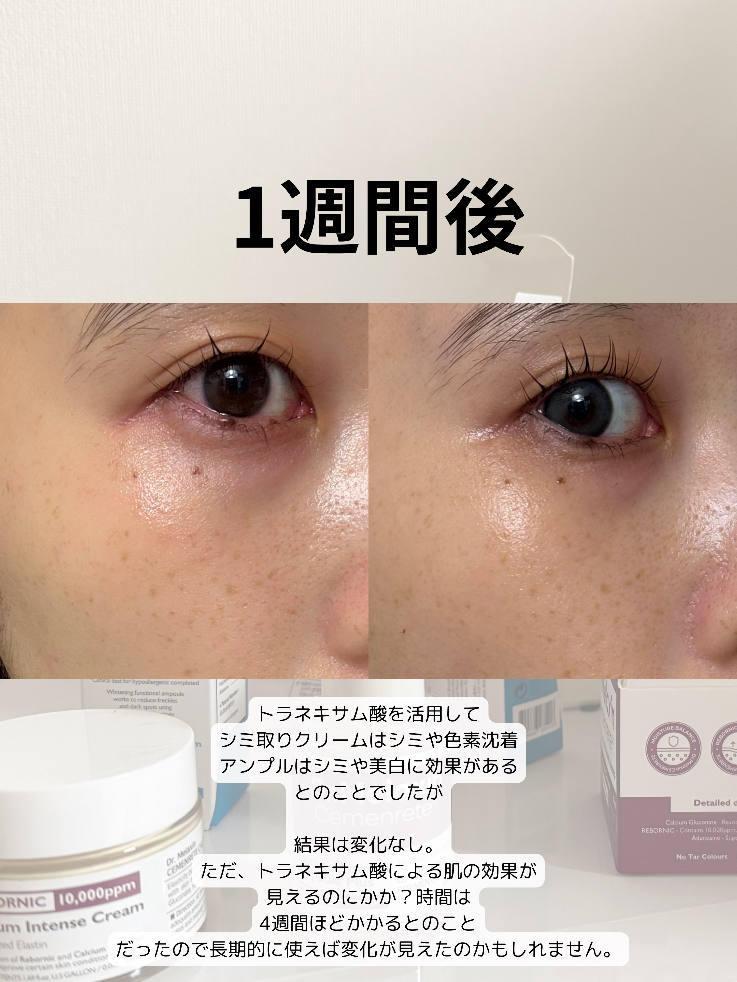 TX - AMPOULE Rx/Dr.Melaxin/美容液を使ったクチコミ（2枚目）