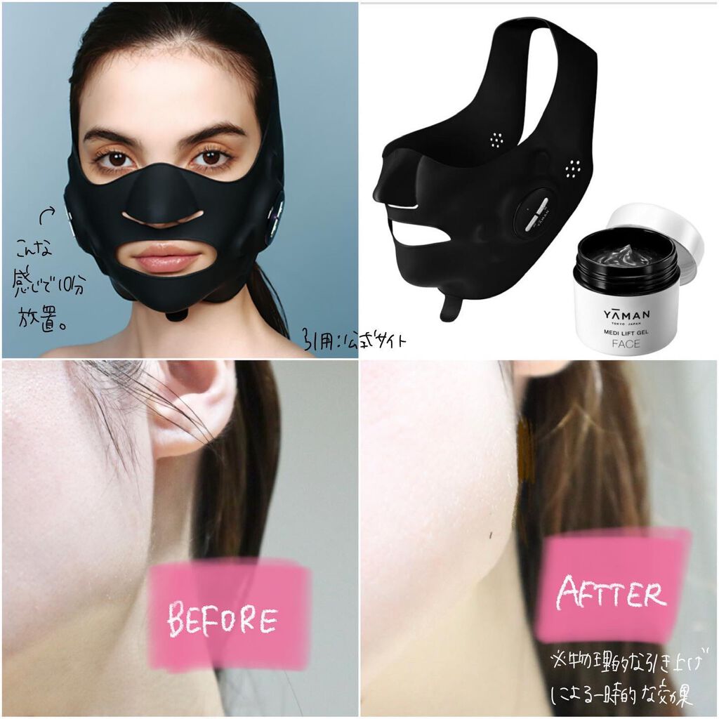 メディリフト /YA-MAN TOKYO JAPAN/美顔器・マッサージを使ったクチコミ(3枚目)