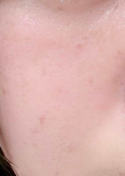 乳液・敏感肌用・高保湿タイプ/無印良品/乳液を使ったクチコミ(2枚目)