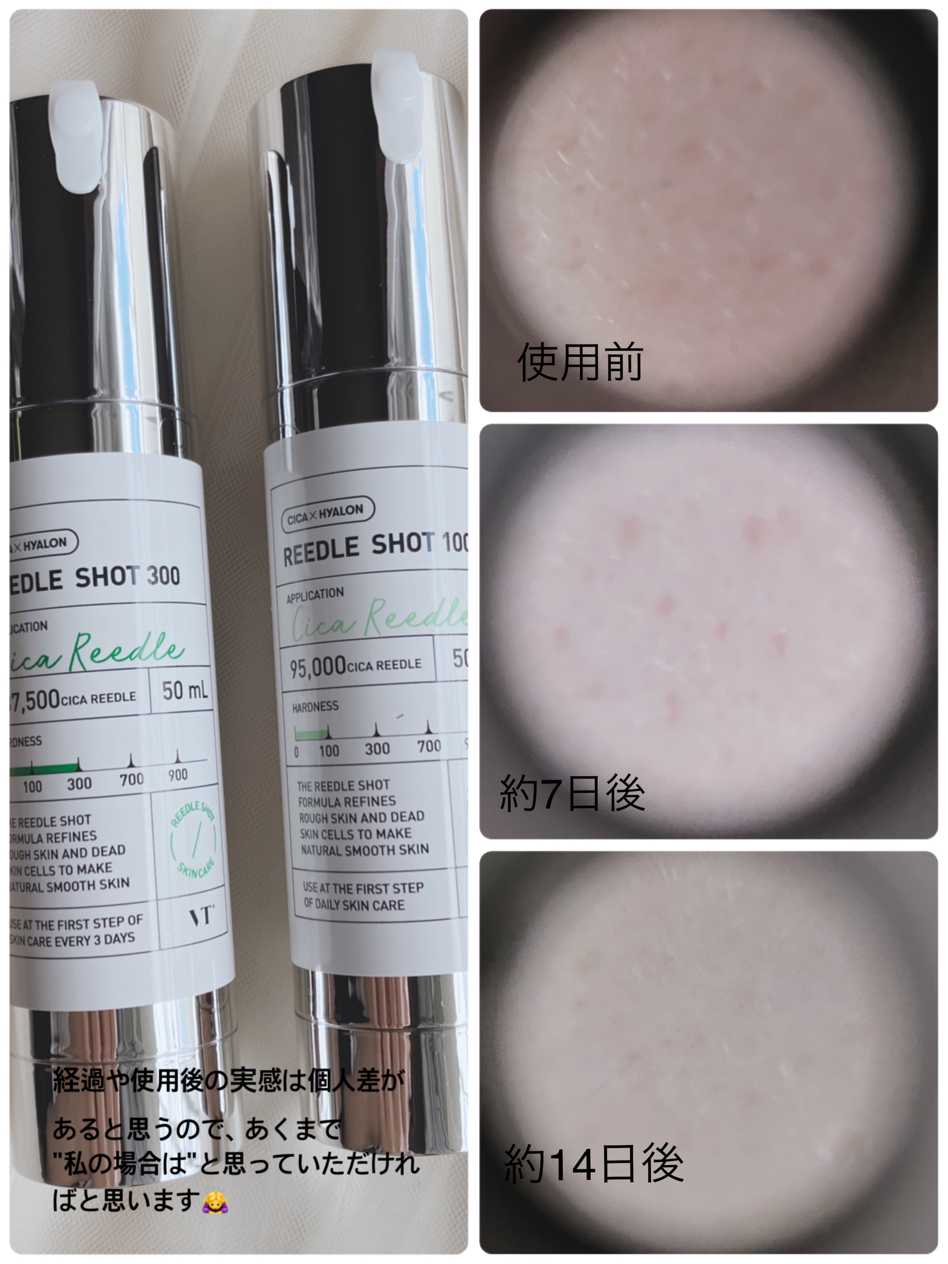 VTの美容液 リードルショット100＆リードルショット300を使った
