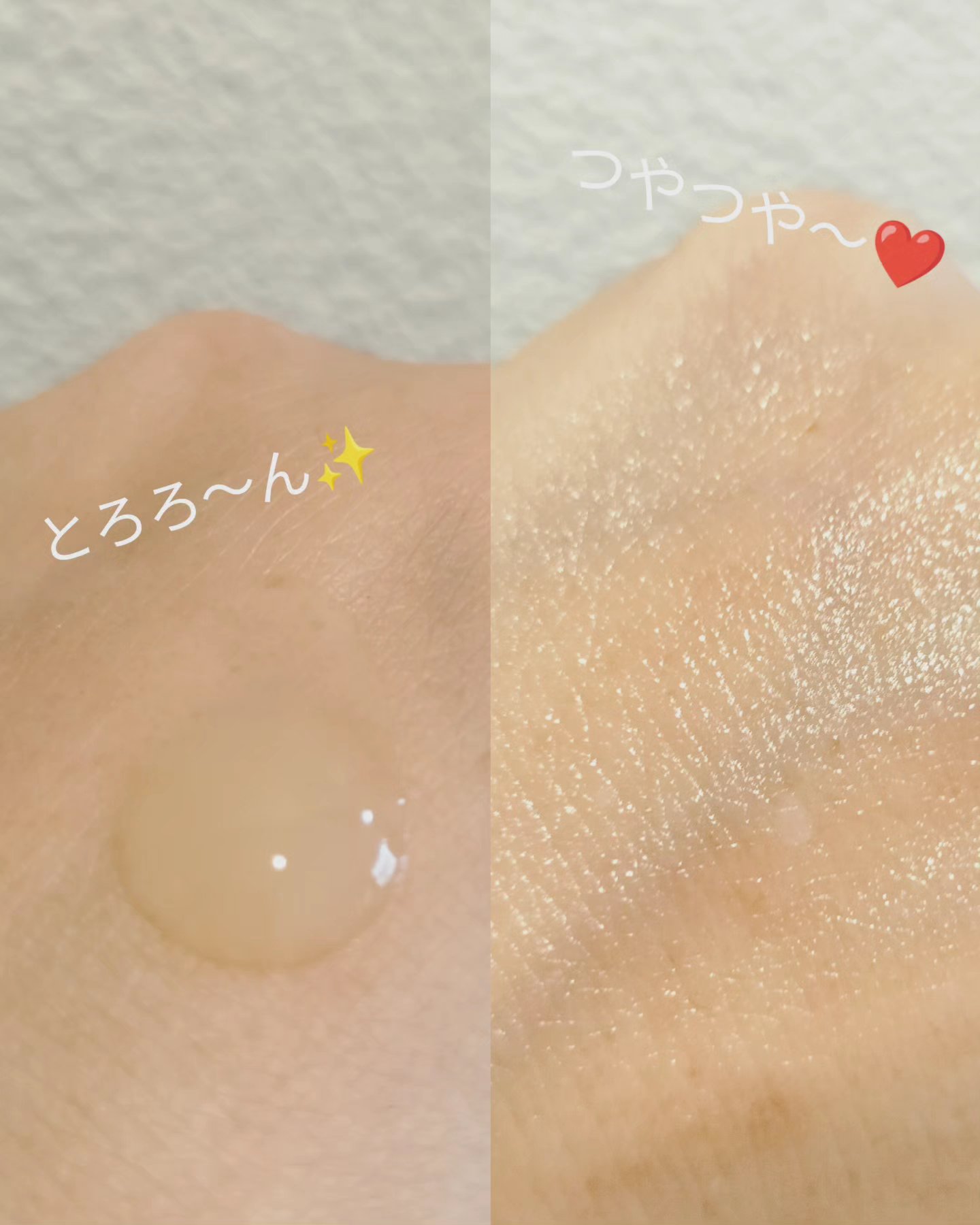 プロビタC ブライトニング アンプルセラム/One-day's you/美容液を使ったクチコミ（2枚目）