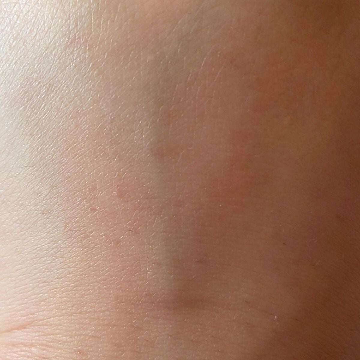 美白乃美人ピーリングジェル/ブレーンコスモス/ピーリングを使ったクチコミ(5枚目)