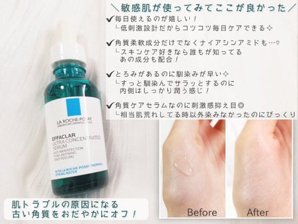 エファクラ ピールケア セラム/ラ ロッシュ ポゼ/美容液を使ったクチコミ(3枚目)