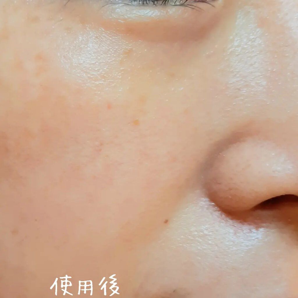 夏雪草バランシングマスク/我的美麗日記/シートマスク・パックを使ったクチコミ(8枚目)