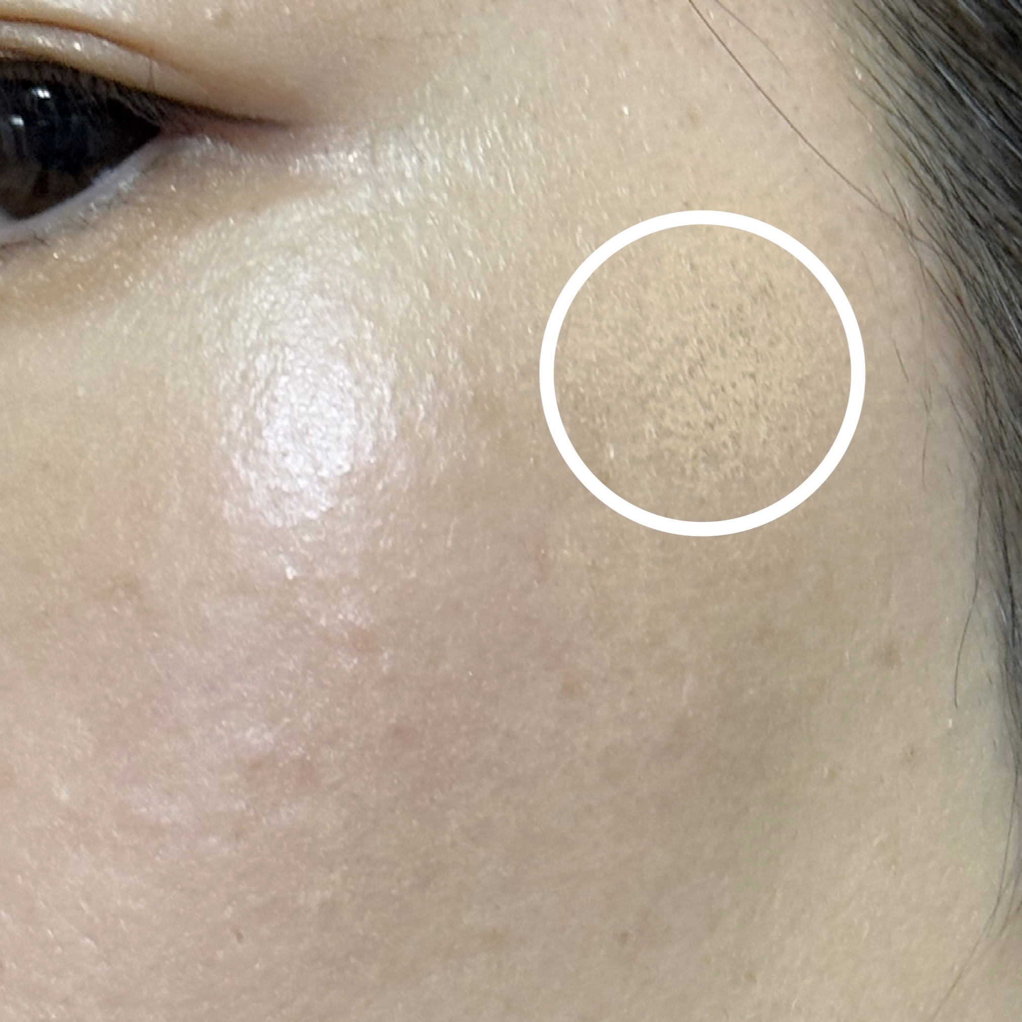 リアル フローレス ウェイトレス パーフェクティング コンシーラー/ローラ メルシエ/リキッドコンシーラーを使ったクチコミ（3枚目）