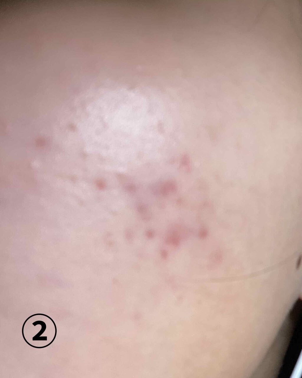 ハトムギ化粧水(ナチュリエ スキンコンディショナー R )/ナチュリエ/化粧水を使ったクチコミ（3枚目）