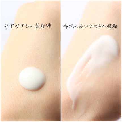 モイスチュア キー/カルテHD/オールインワン化粧品を使ったクチコミ(4枚目)