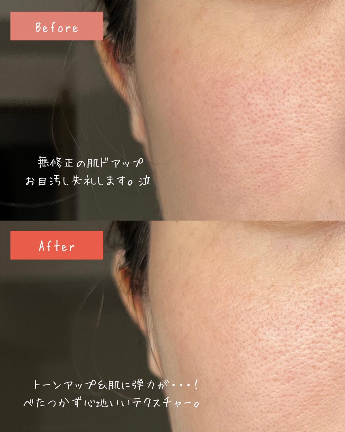 メディプラスゲル/メディプラス/オールインワン化粧品を使ったクチコミ(4枚目)