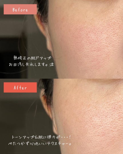 メディプラスゲル/メディプラス/オールインワン化粧品を使ったクチコミ(4枚目)