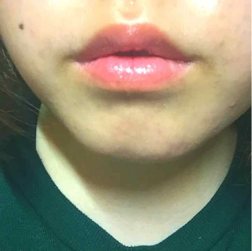 リップケアUV/スキンアクア/リップケアを使ったクチコミ(3枚目)