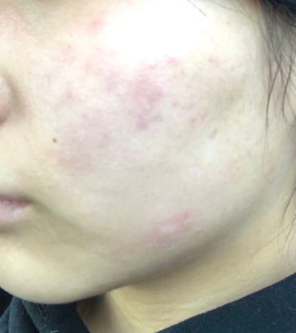 cocco on LIPS 「こんにちは!アドバイス頂きたくて投稿します。私の肌はおそらく、..」(4枚目)