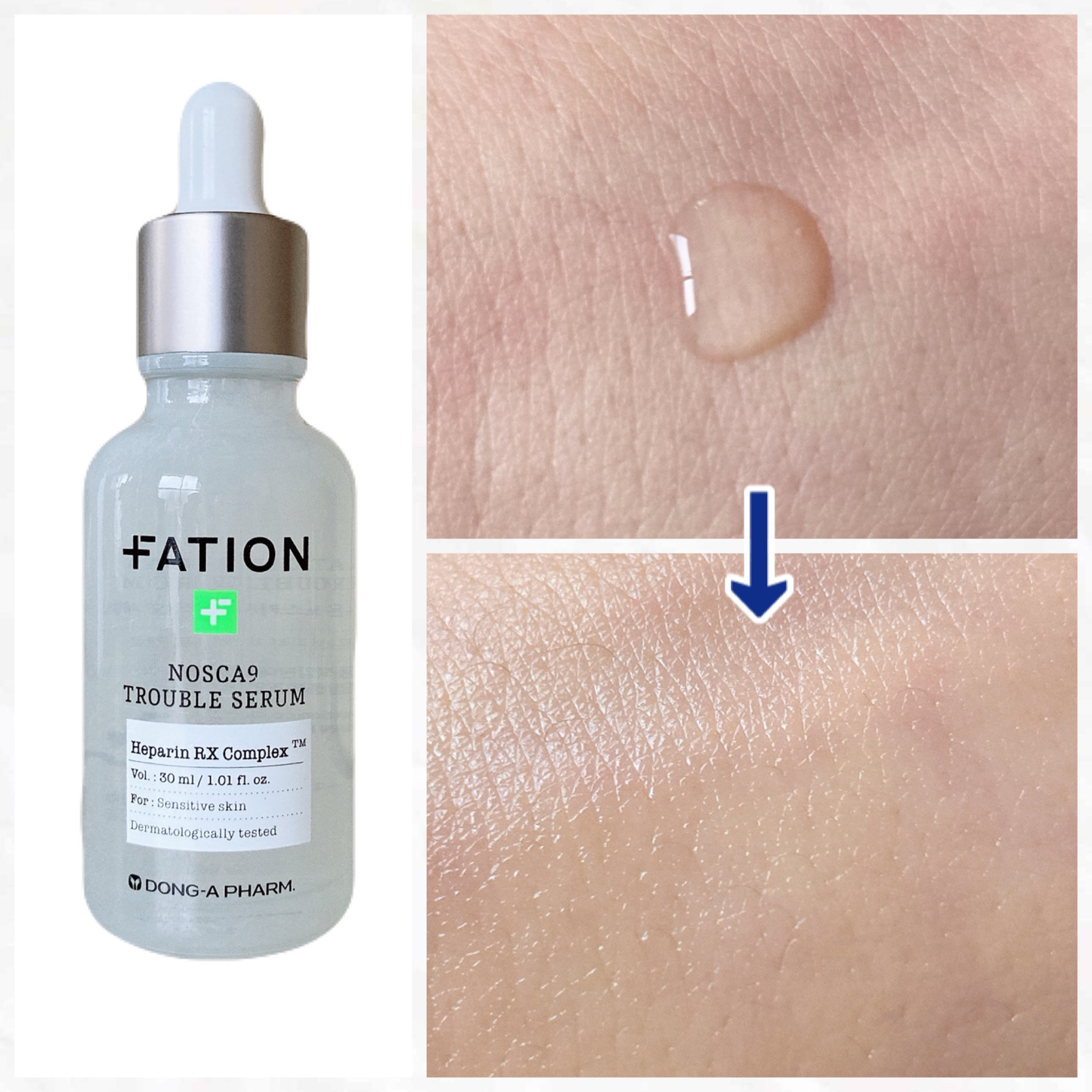 〔商品名〕
FATION
ノスカナイン トラブル セラム

〔商品詳細〕
肌トラブルを速く鎮静させてくれるセラムです。傷んだ肌の治癒に最適。低刺激製品なので敏感性・ニキビ肌にも安心して使えます。

〔感想〕
混合肌なので、しっとりするのに全