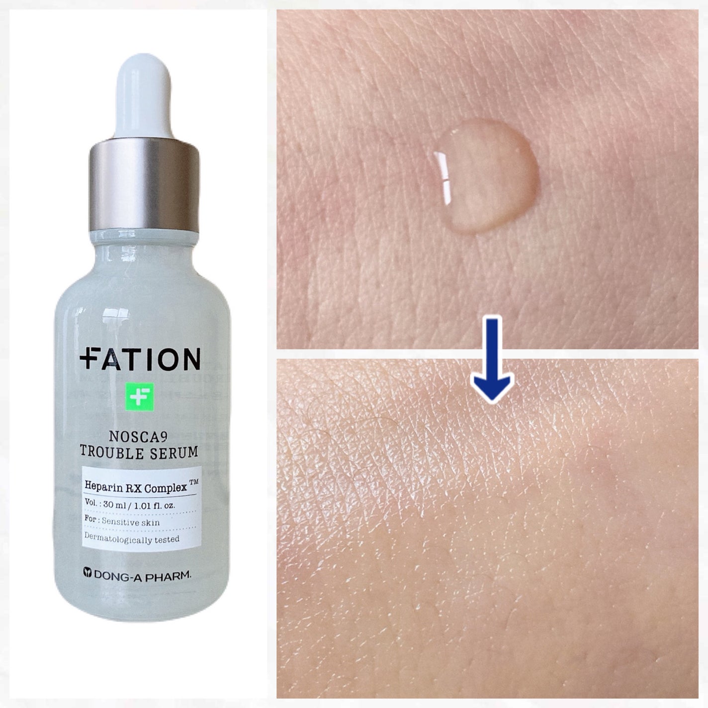 ノスカナイン トラブル セラム/FATION/美容液を使ったクチコミ(1枚目)