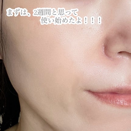 パンテショット675/COSNORI/美容液を使ったクチコミ(5枚目)