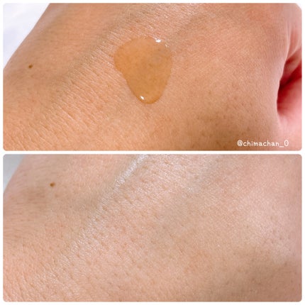 RXザ・アルファアルブチン2 ニキビ跡ケアセラム/COSRX/美容液を使ったクチコミ(3枚目)