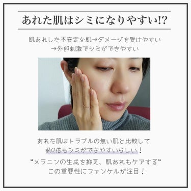 ホワイトニング 化粧液 II しっとり＜医薬部外品＞/ファンケル/化粧水を使ったクチコミ（2枚目）