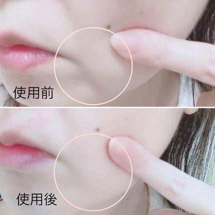 PLUMINUS/mous./美顔器・マッサージを使ったクチコミ(6枚目)