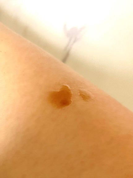 レディブラン 薬用美白ピールホワイト/シーヴァ/洗い流すパック・マスクを使ったクチコミ(2枚目)