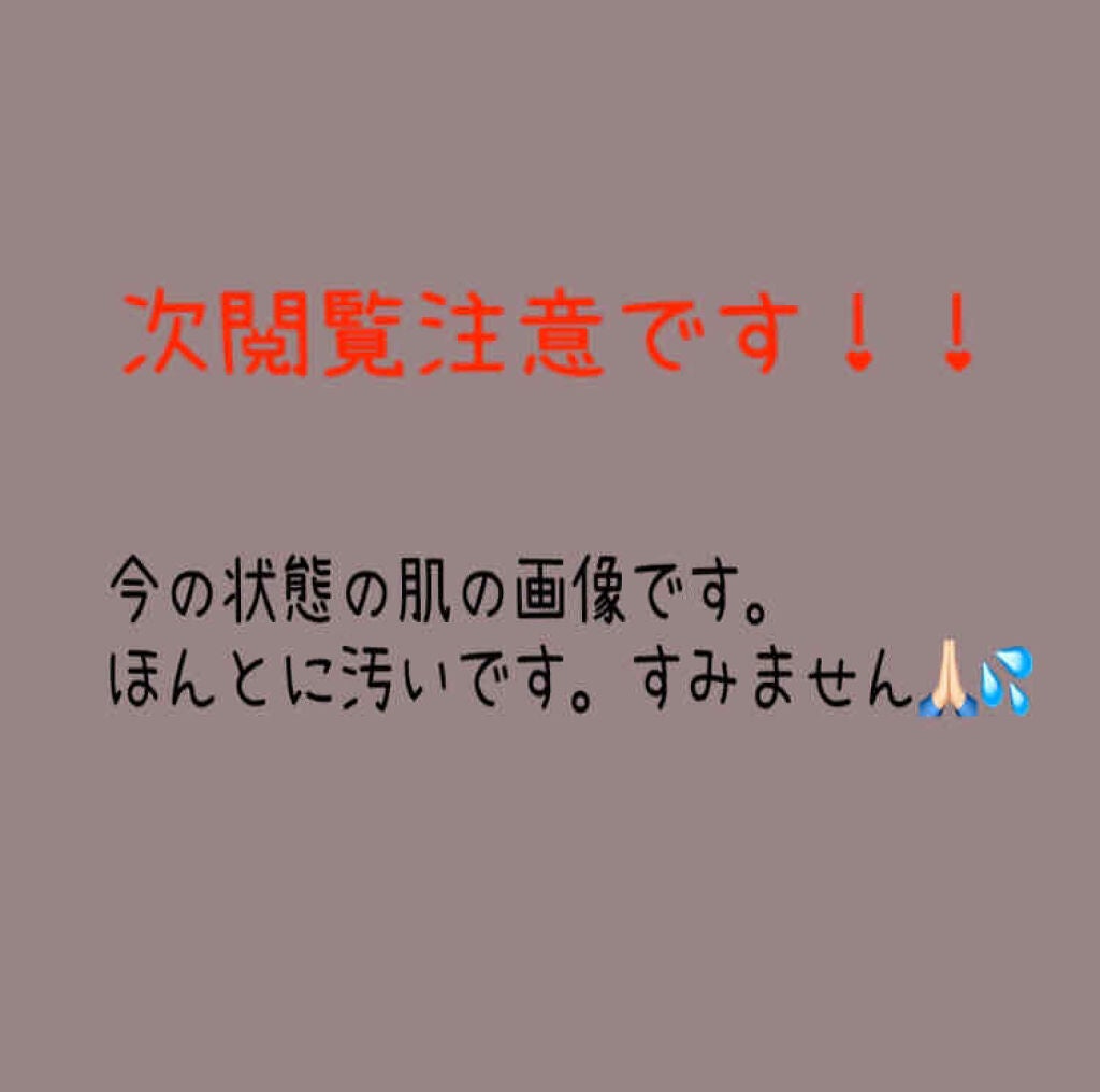 マスキング レイアリング アンプル /MEDIHEAL/美容液を使ったクチコミ(2枚目)
