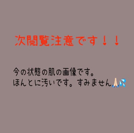 マスキング レイアリング アンプル /MEDIHEAL/美容液を使ったクチコミ(2枚目)
