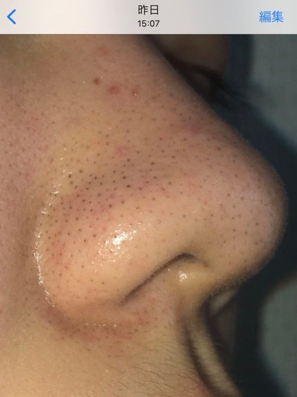 スイサイ ビューティクリア パウダーウォッシュ/スイサイ ビューティクリア/洗顔パウダーを使ったクチコミ(2枚目)