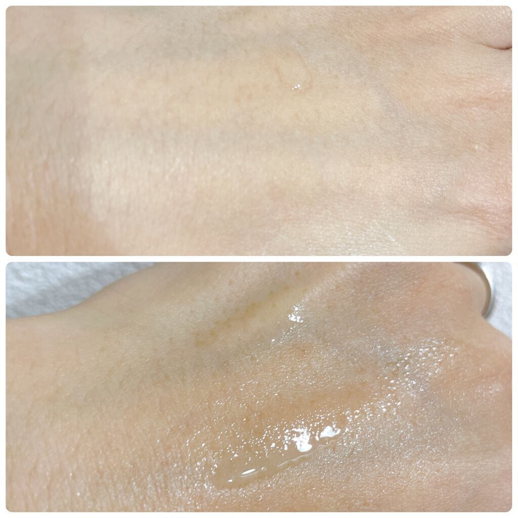 薬用クリアスキンケアセット/IHADA/スキンケアキットを使ったクチコミ（2枚目）