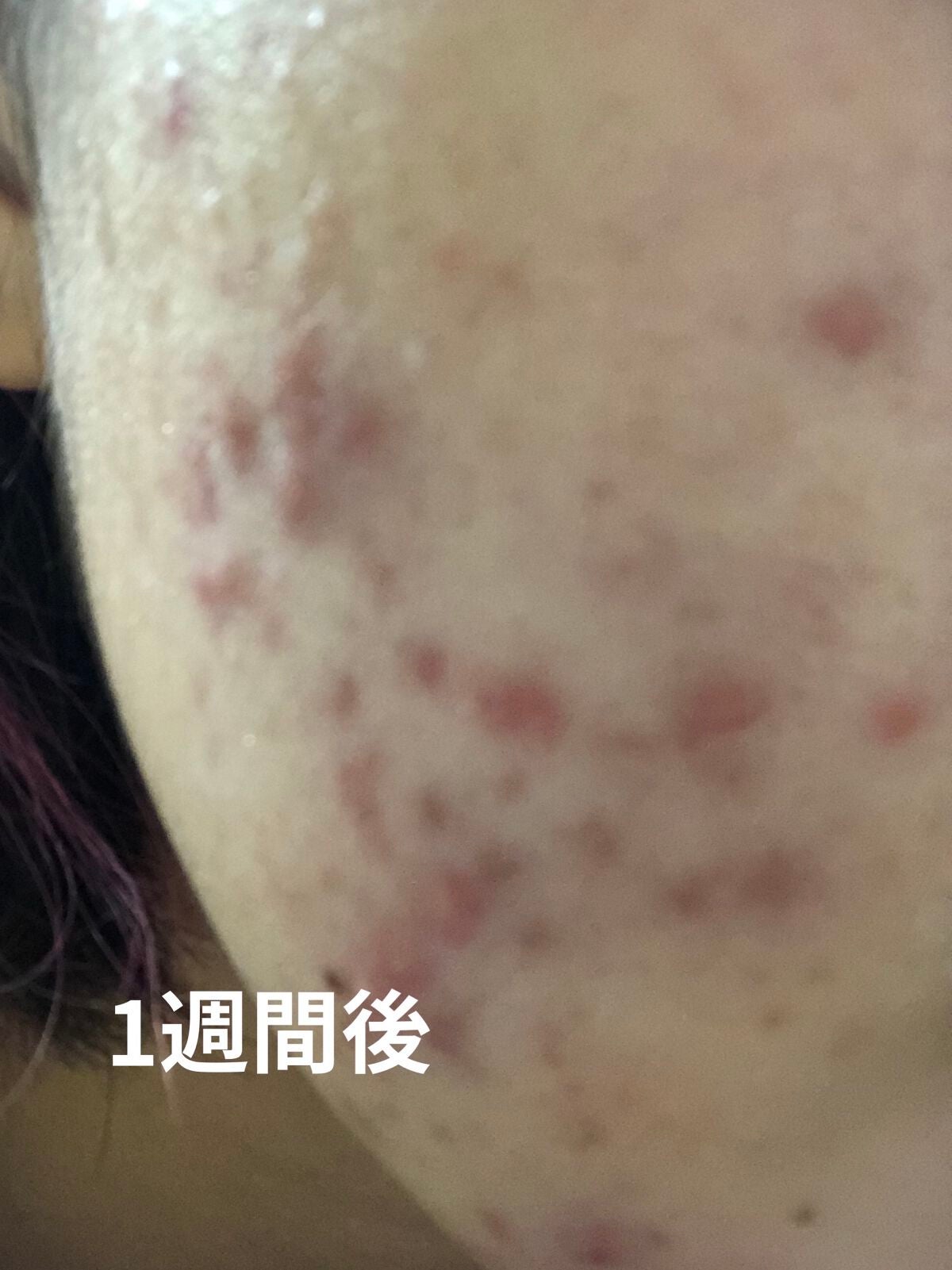 ドクダミ 77 スージングトナー/Anua/化粧水を使ったクチコミ(7枚目)