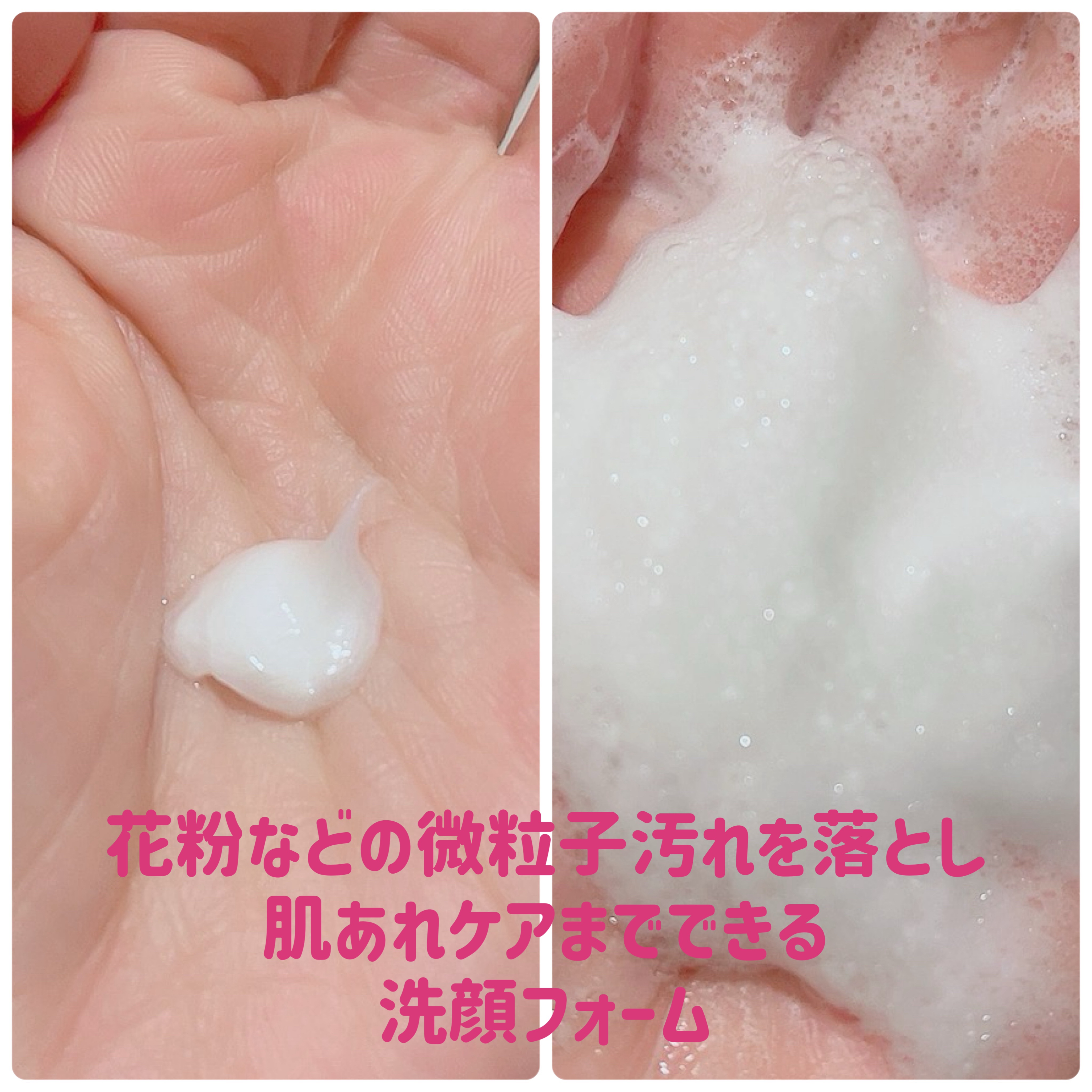 アレルバリア ミスト/d プログラム/ミスト状化粧水を使ったクチコミ（3枚目）