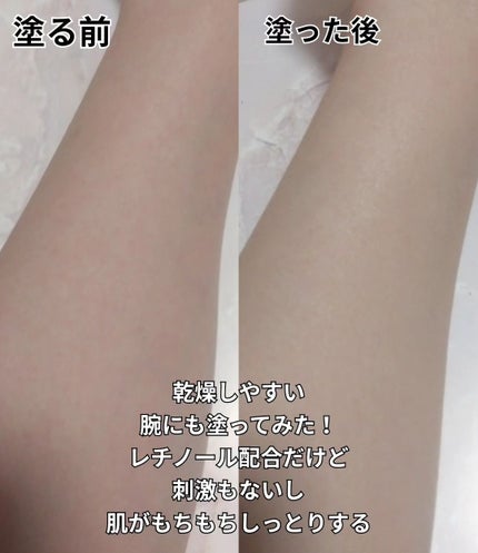 ãŽã¡ã»ãªã³ãªãã¢ã¯ãªãŒã ãã€ãã±ã¢/ãŽã¡ã»ãªã³/ããã£ã¯ãªãŒã ã䜿ã£ãã¯ãã³ãïŒ4æç®ïŒ