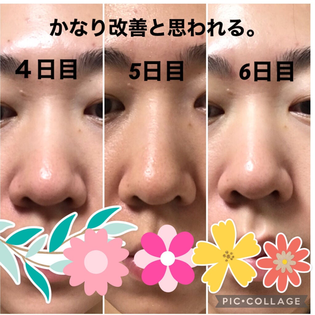 スムージングジェルウォッシュ/LUNASOL/洗顔フォームを使ったクチコミ(5枚目)